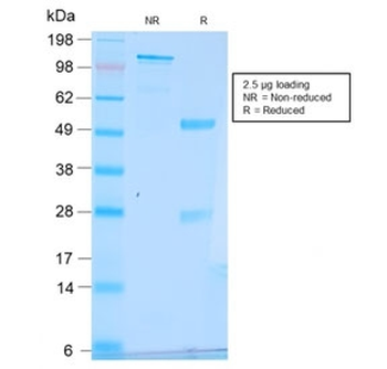 Estrogen Inducible Protein pS2 / TFF1 Antibody