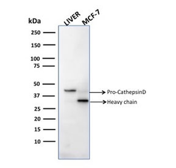 CTSD Antibody / Cathepsin D
