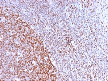 Nuclear Antigen Antibody