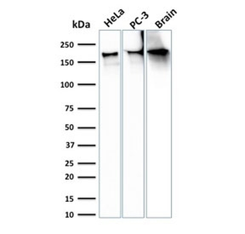 SPTBN2 Antibody / Spectrin beta III