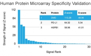 Dystrophin Antibody / DMD