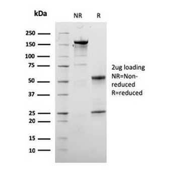 Dystrophin Antibody / DMD