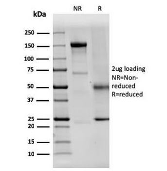 Dystrophin Antibody / DMD