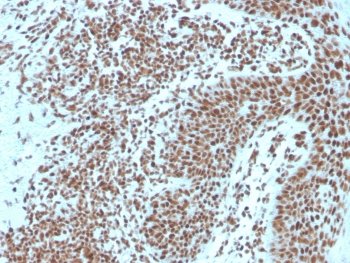 Nucleophosmin Antibody / NPM1