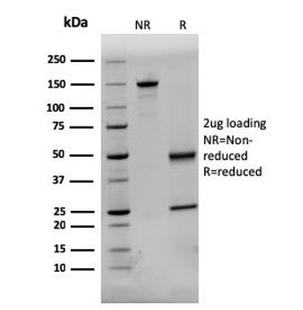 Dystrophin Antibody / DMD