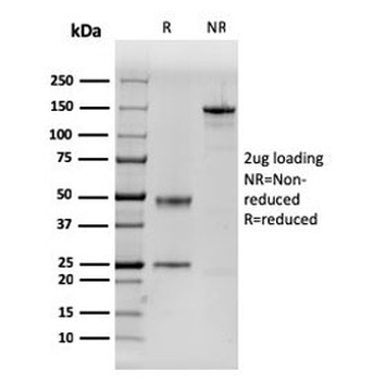 Dystrophin Antibody / DMD