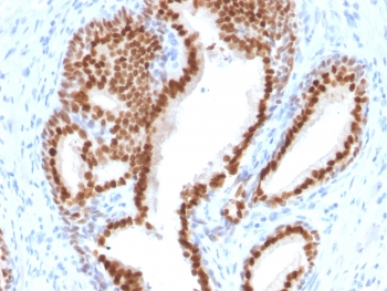 NKX3.1 Antibody