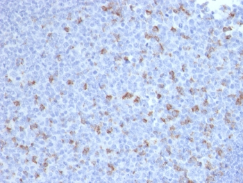 PDCD1 Antibody / PD-1 / PD1