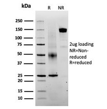 SERBP1 Antibody / PAI-RBP1