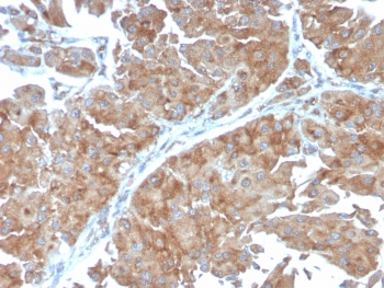 SERBP1 Antibody / PAI-RBP1