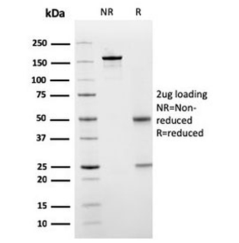 SERBP1 Antibody / PAI-RBP1