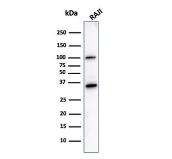 CD20 Antibody
