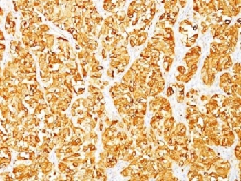 MART-1 / Melan-A Antibody
