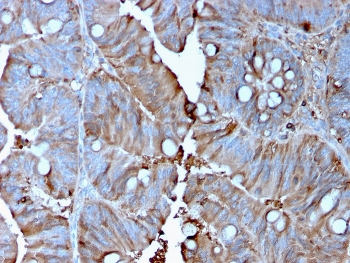 MerTK Antibody