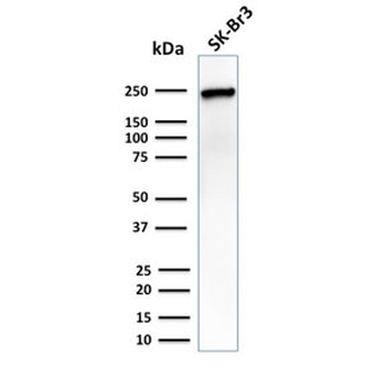 CHD4 Antibody / Chromodomain helicase DNA binding protein 4