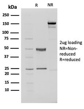 CHD4 Antibody / Chromodomain helicase DNA binding protein 4