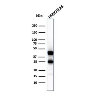 Carboxypeptidase A1 Antibody / CPA1