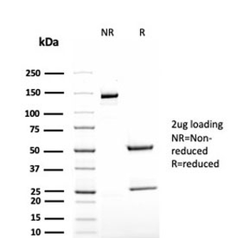 TAG-72 Antibody