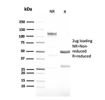 CSF3 Antibody / Granulocyte-Colony Stimulating Factor