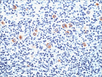 CD15 Antibody / SSEA-1
