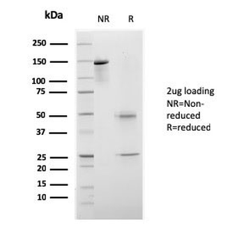 CELA3B Antibody / Elastase 3B