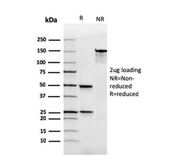 IgA Heavy Chain Antibody