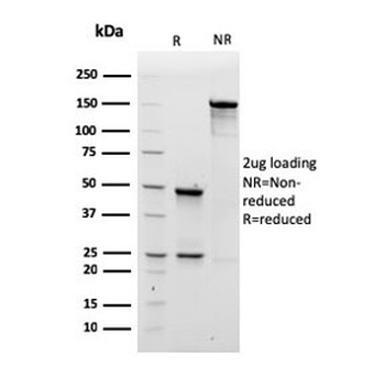 IgM Heavy Chain Antibody