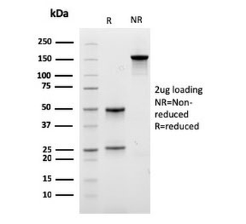 Lambda Light Chain Antibody / Lambda Antibody