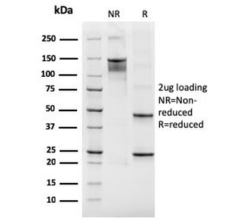 Integrin beta 3 Antibody / ITGB3 / CD61