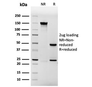 Involucrin Antibody