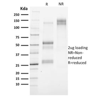 Cytokeratin 3 Antibody / KRT3