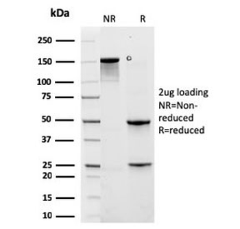 Cytokeratin 6A Antibody