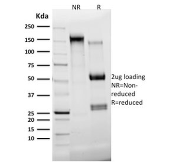 KRT7 Antibody / Cytokeratin 7