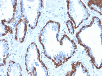 Cytokeratin 13 Antibody / KRT13