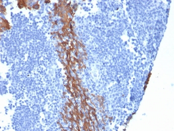 Cytokeratin 13 Antibody / KRT13