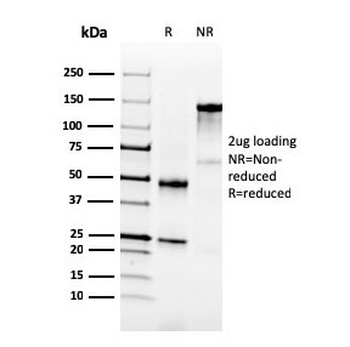 NKX3.1 Antibody