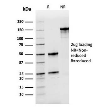 Nucleophosmin Antibody / NPM1