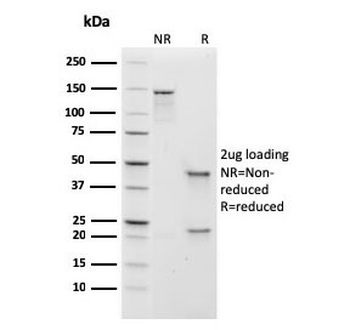 IgM Heavy Chain Antibody