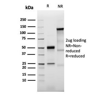 Prolactin Receptor Antibody / PRLR