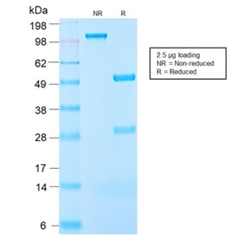 IGF-1 Antibody / Insulin like Growth Factor 1