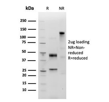 IgM Heavy Chain Antibody