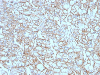 PD-L1 Antibody / B7-H1 / CD274