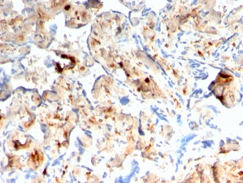S100A4 Antibody / FSP1