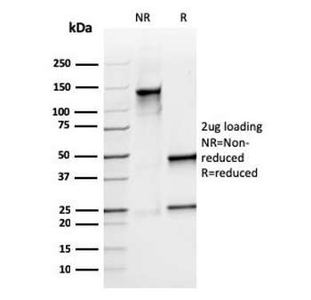 S100A9 Antibody / MRP14 / Calgranulin B / Calprotectin L1H