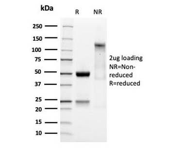 SOX9 Antibody