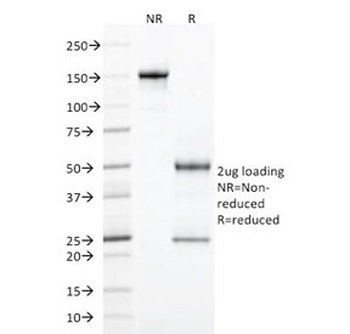 StAR Antibody / Steroidogenic acute regulatory protein