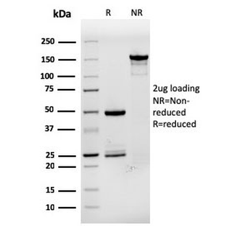 Estrogen Inducible Protein pS2 / TFF1 Antibody