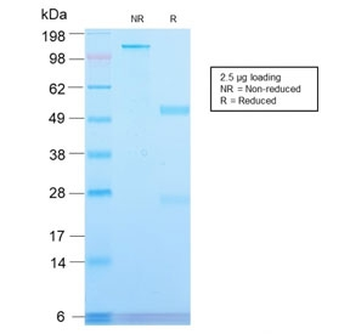 Transferrin Receptor Antibody / TFRC / CD71 / Extracellular domain