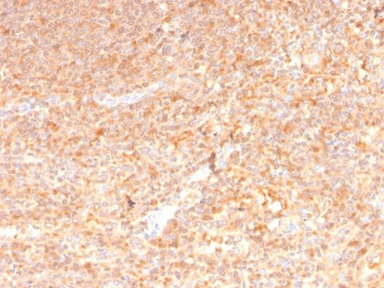 Granulocyte-Macrophage CSF Antibody / CSF2