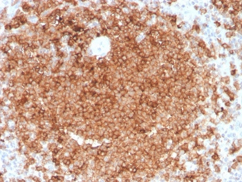 Granulocyte-Macrophage CSF Antibody / CSF2